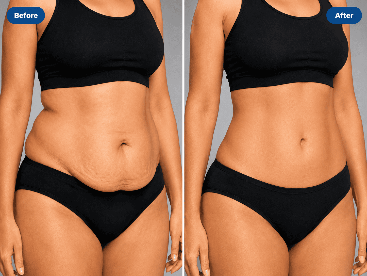 Body contouring before and after results in Jaipur