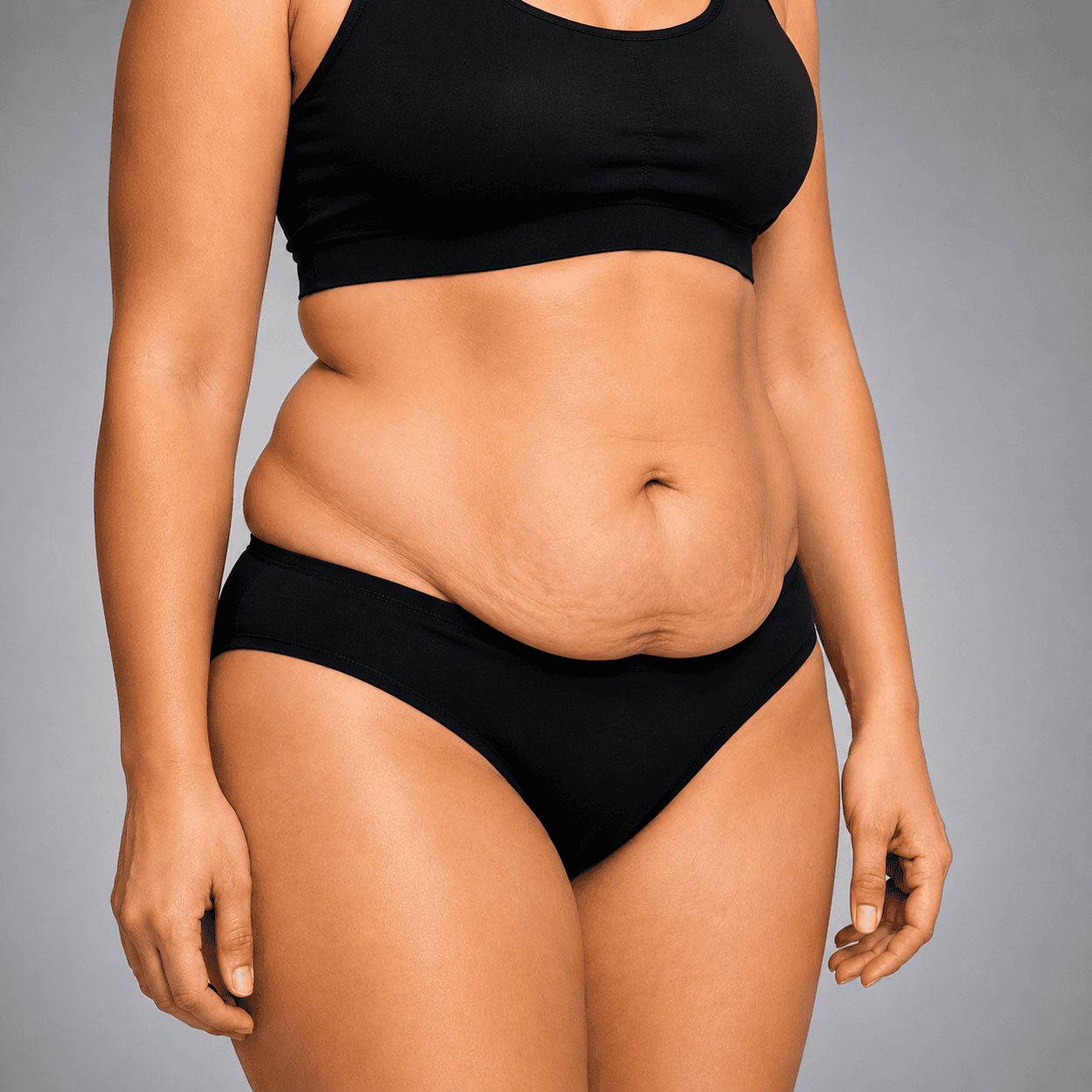 After body contouring surgery