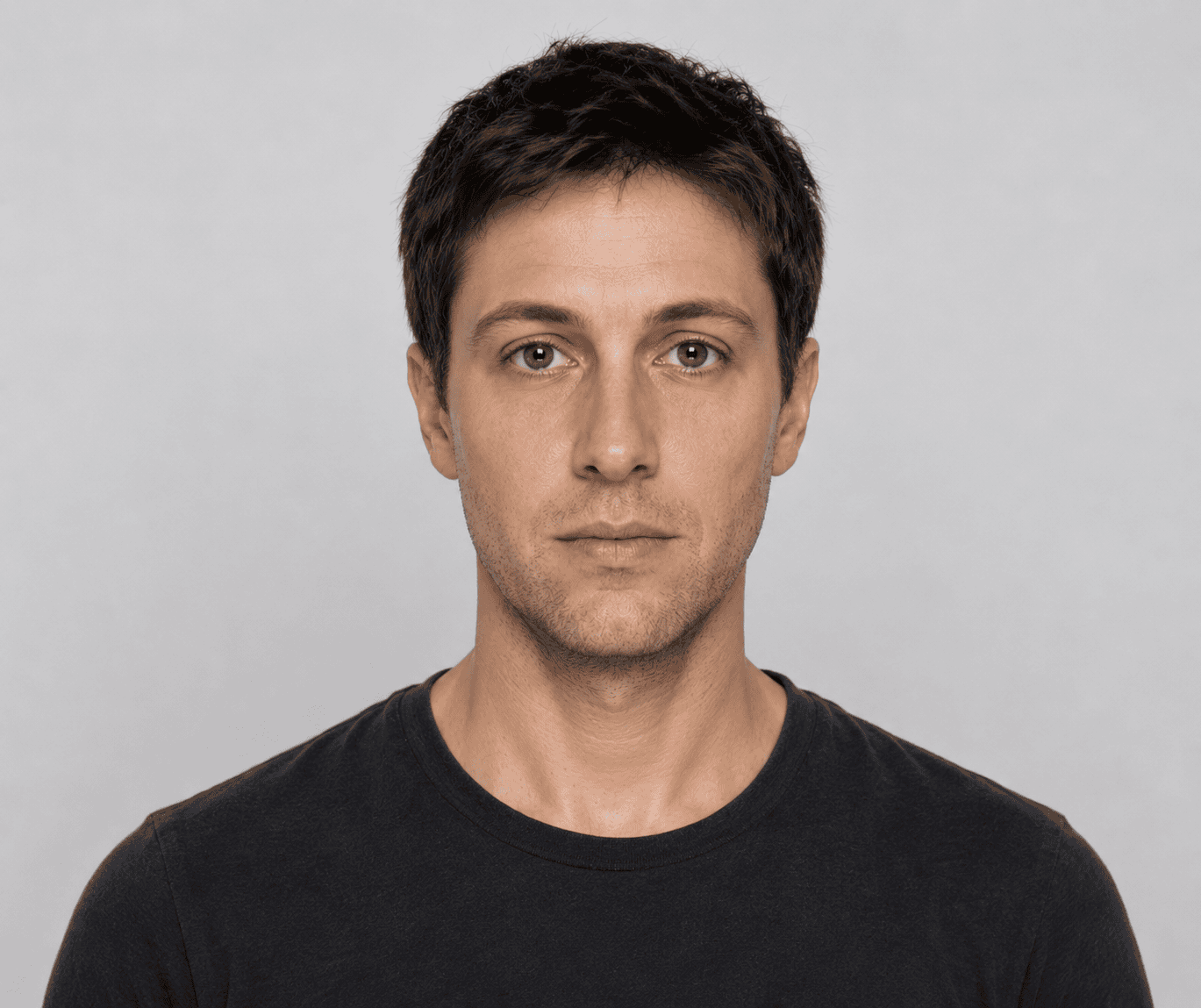 After hair restoration treatment